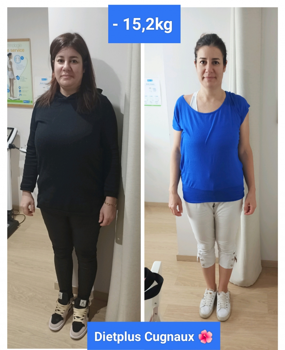 KATY -15 KG 
